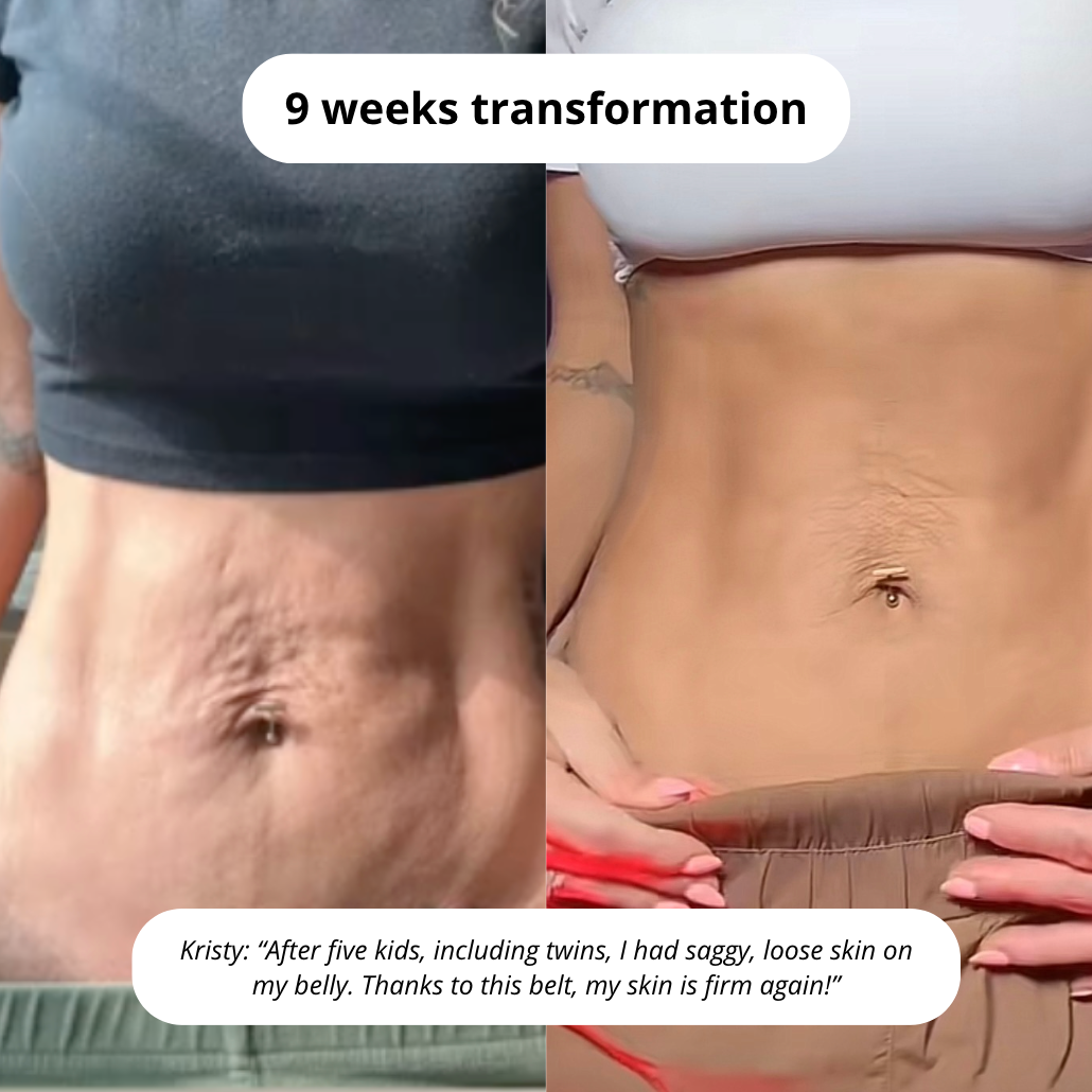 Firmess™ | Postpartum Firming Belt